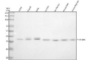 Western blot analysis of P-NFKBIA using anti-P-NFKBIA antibody (ABIN7603306).