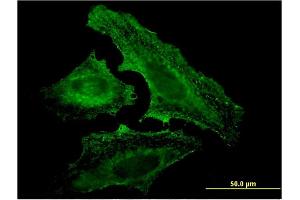 Immunofluorescence of monoclonal antibody to UVRAG on HeLa cell. (UVRAG Antikörper  (AA 601-699))