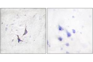 Immunohistochemistry analysis of paraffin-embedded human brain tissue, using Syndecan4 (Ab-179) Antibody. (SDC4 Antikörper  (AA 145-194))