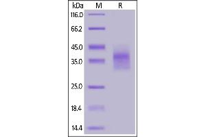 Human LILRB4, His Tag (SPR verified) on  under reducing (R) condition. (LILRB4 Protein (AA 22-259) (His tag))