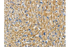 ABIN6265546 and ABIN6266641 at 1/100 staining Rat heart tissue by IHC-P.