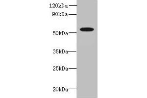 Western blot All lanes: L2HGDH antibody at 8 μg/mL + K562 whole cell lysate Secondary Goat polyclonal to rabbit IgG at 1/10000 dilution Predicted band size: 51, 49 kDa Observed band size: 51 kDa (L2HGDH Antikörper  (AA 52-463))
