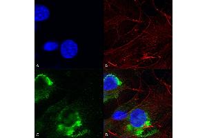 Immunocytochemistry/Immunofluorescence analysis using Mouse Anti-GFAP R416WT Monoclonal Antibody, Clone S206B-9 (ABIN1740964). (GFAP Antikörper  (AA 411-422) (Atto 390))