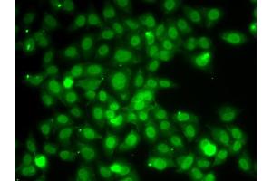 Immunofluorescence analysis of A549 cells using TRAF4 antibody.