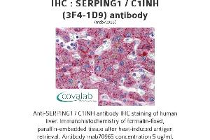 Image no. 1 for anti-Serpin Peptidase Inhibitor, Clade G (C1 Inhibitor), Member 1 (SERPING1) (AA 1-501), (full length) antibody (ABIN1723814) (SERPING1 Antikörper  (full length))