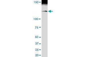 Immunoprecipitation of MYBBP1A transfected lysate using anti-MYBBP1A MaxPab rabbit polyclonal antibody and Protein A Magnetic Bead , and immunoblotted with MYBBP1A MaxPab mouse polyclonal antibody (B01) . (MYBBP1A Antikörper  (AA 1-1328))