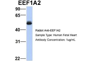 Host:  Rabbit  Target Name:  EEF1A2  Sample Type:  Human Fetal Heart  Antibody Dilution:  1. (EEF1A2 Antikörper  (Middle Region))