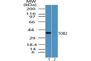 Image no. 1 for anti-Transducer of ERBB2, 2 (TOB2) (AA 50-100) antibody (ABIN960385) (TOB2 Antikörper  (AA 50-100))