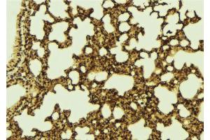 ABIN6273296 at 1/100 staining Mouse lung tissue by IHC-P. (PHF19 Antikörper  (Internal Region))