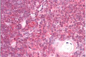 Immunohistochemistry (IHC) image for anti-DEAD (Asp-Glu-Ala-Asp) Box Polypeptide 6 (DDX6) (C-Term) antibody (ABIN185580)