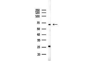 anti-GATA Binding Protein 6 (GATA6) (Internal Region) antibody