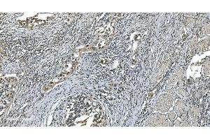 IHC analysis of LSM7 using anti-LSM7 antibody (ABIN7598937).