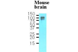 Western Blotting (WB) image for anti-Amyloid beta (A4) Precursor Protein (APP) (AA 18-289) antibody (ABIN317497) (APP Antikörper  (AA 18-289))