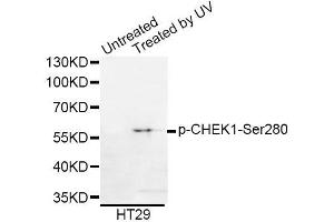 Western blot analysis of extracts of HT-29 cells, using Phospho-CHEK1-Ser280 antibody (ABIN5969878). (CHEK1 Antikörper  (pSer280))