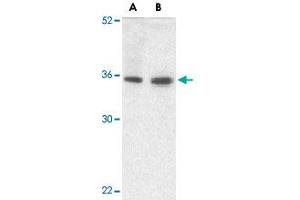 Western blot analysis of TRIM5 gamma expression in human bladder (A) and colon (B) tissue lysate with TRIM5 gamma polyclonal antibody  at 2 ug /mL . (TRIM5 Antikörper  (C-Term))