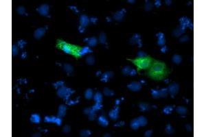 Anti-SHPK mouse monoclonal antibody (ABIN2454805) immunofluorescent staining of COS7 cells transiently transfected by pCMV6-ENTRY SHPK (RC204421). (SHPK Antikörper)