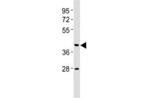 Western blot testing of CB2 antibody at 1:2000 dilution + human brain lysate. (CNR2 Antikörper  (AA 18-53))
