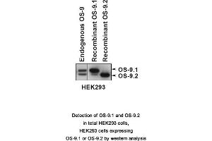 Image no. 1 for anti-Osteosarcoma Amplified 9, Endoplasmic Reticulum Lectin (OS9) (AA 300-400), (Isoform 1) antibody (ABIN363453)