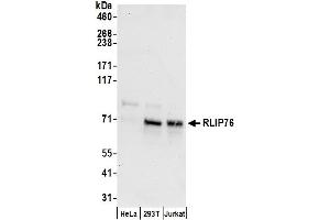Western Blotting (WB) image for anti-RalA Binding Protein 1 (RALBP1) (AA 605-655) antibody (ABIN7450662)