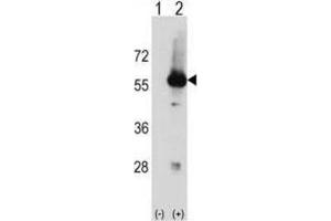 Western Blotting (WB) image for anti-serine/threonine Kinase 3 (STK3) antibody (ABIN2998524) (STK3 Antikörper)