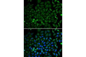 Immunofluorescence analysis of A549 cells using PARK2 antibody (ABIN5998454). (Parkin Antikörper)