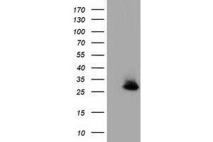 Western Blotting (WB) image for anti-Glutathione S-Transferase theta 2 (GSTT2) antibody (ABIN1498558) (GSTT2 Antikörper)
