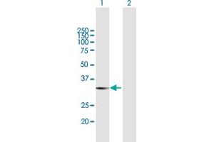 Western Blot analysis of LGALS8 expression in transfected 293T cell line by LGALS8 MaxPab polyclonal antibody. (LGALS8 Antikörper  (AA 1-317))