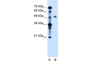WB Suggested Anti-SLC39A6 Antibody Titration:  1.