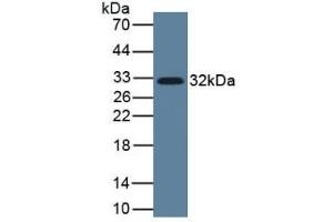 Detection of IL33 in Human Lung Tissue using Monoclonal Antibody to Interleukin 33 (IL33) (IL-33 Antikörper  (AA 112-270))