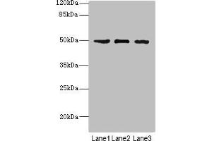 Western blot All lanes: CSNK1G1 antibody at 1. (CSNK1G1 Antikörper  (Isoform gamma 1))