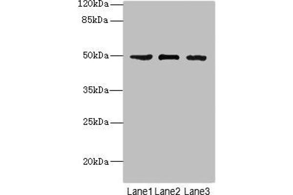 CSNK1G1 Antikörper  (Isoform gamma 1)