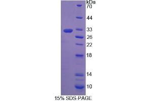 SDS-PAGE (SDS) image for Prostaglandin F2 Receptor Negative Regulator (PTGFRN) (AA 22-263) protein (His tag) (ABIN6238838)