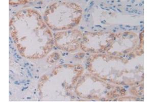 IHC-P analysis of Human Kidney Tissue, with DAB staining. (GDF6 Antikörper  (AA 336-455))
