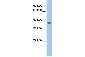 WB Suggested Anti-ZFP36 Antibody Titration:  0. (ZFP36 Antikörper  (N-Term))