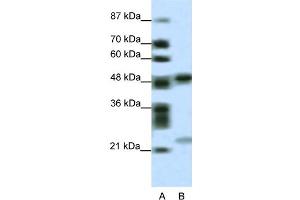 WB Suggested Anti-PHF11 Antibody Titration:  0. (PHF11 Antikörper  (Middle Region))