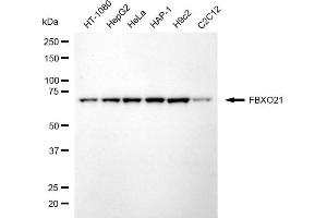 Western blotting analysis using FBXO21 antibody (ABIN7798555).