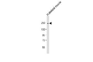 Anti-MYH2 Antibody (N-Term) at 1:2000 dilution + human skeletal muscle lysate Lysates/proteins at 20 μg per lane. (MYH2 Antikörper  (AA 350-382))