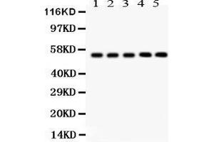 Anti- YB1 Picoband antibody, Western blotting All lanes: Anti YB1  at 0. (YBX1 Antikörper  (C-Term))
