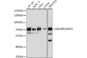 Western blot analysis of extracts of various cell lines, using IGF2BP2/IMP2 antibody (ABIN6131799, ABIN6142242, ABIN6142244 and ABIN6218878) at 1:1000 dilution. (IGF2BP2 Antikörper  (AA 330-599))