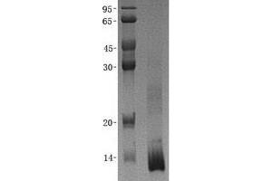 Western Blotting (WB) image for Dynein, Light Chain, LC8-Type 1 (DYNLL1) (Transcript Variant 1) protein (His tag) (ABIN2712279)