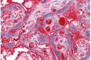 Human Placenta: Formalin-Fixed, Paraffin-Embedded (FFPE) (APOA2 Antikörper  (AA 1-100))