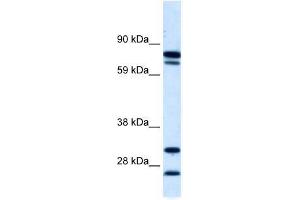 ZNF606 antibody used at 5 ug/ml to detect target protein. (ZNF606 Antikörper  (N-Term))