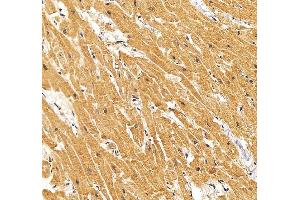 IHC analysis of RYR2 using anti-RYR2 antibody (ABIN7599921). (RYR2 Antikörper  (AA 1293-1423))