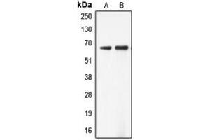 Western blot analysis of ADCK5 expression in Jurkat (A), SW13 (B) whole cell lysates. (ADCK5 Antikörper  (Center))