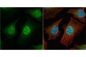 Immunofluorescence (IF) image for anti-Baculoviral IAP Repeat-Containing 5 (BIRC5) (C-Term) antibody (ABIN2857039)