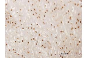 Immunoperoxidase of monoclonal antibody to SMAD6 on formalin-fixed paraffin-embedded human esophagus. (SMAD6 Antikörper  (AA 285-384))