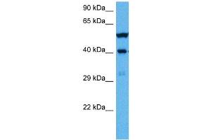 Western Blotting (WB) image for anti-Wilms Tumor 1 (WT1) (Middle Region) antibody (ABIN2780340)