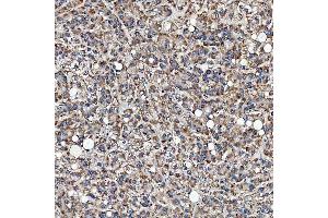 IHC analysis of SFXN3 using anti-SFXN3 antibody (ABIN7601302). (SFXN3 Antikörper  (AA 32-321))