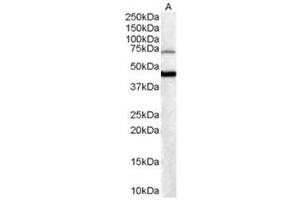 Image no. 1 for anti-Forkhead Box G1 (FOXG1) (C-Term) antibody (ABIN374263)