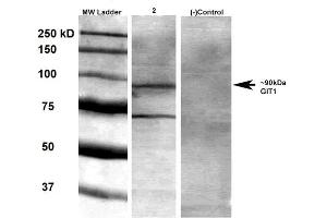 Western Blot analysis of Rat brain membrane lysate showing detection of GIT1 protein using Mouse Anti-GIT1 Monoclonal Antibody, Clone S39B-8 . (GIT1 Antikörper  (AA 375-770) (Biotin))
